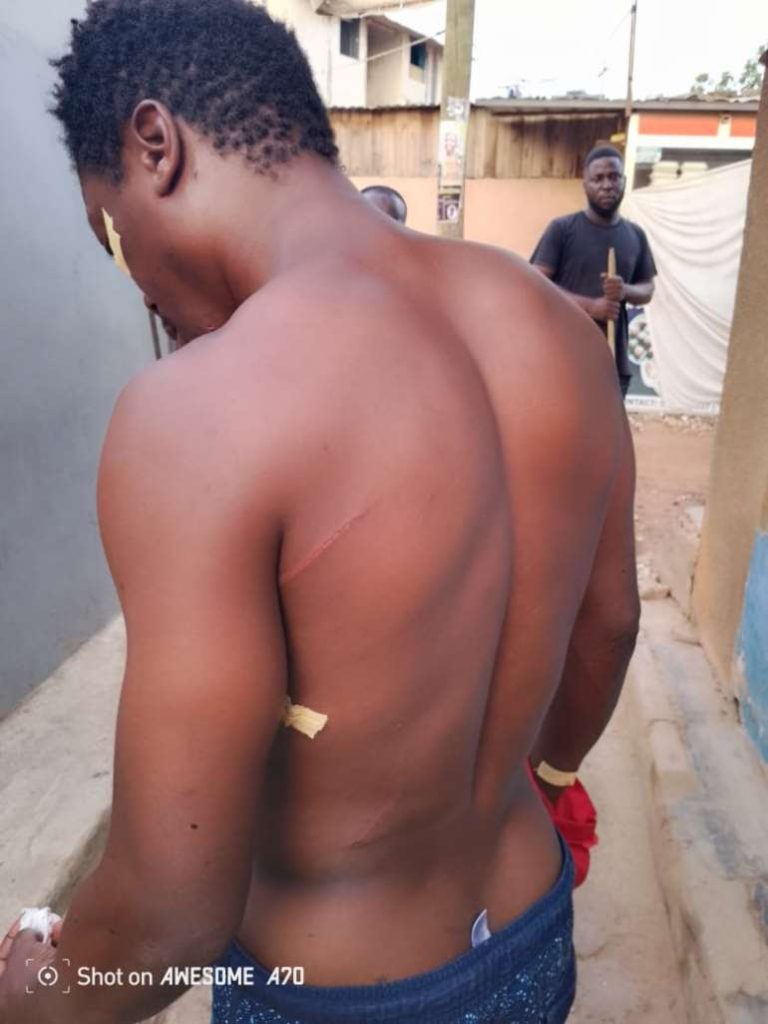 Man escapes death after multiple stabs by thief at Tema