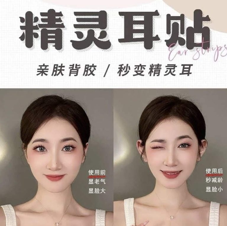 China’s Obsession with Protruding ‘Elf Ears’